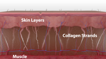 As we age, the collagen that keeps skin firm breaks down, resulting in sagging skin, fine lines, and wrinkles.