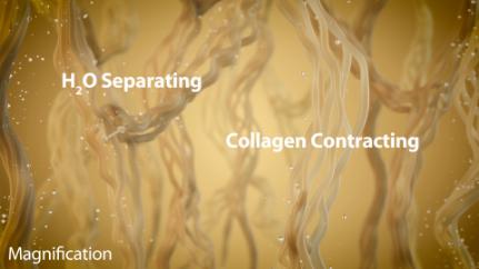 The applied heat separates the water molecules from the fibrous collagen, causing an immediate contraction, resulting in skin tightening.